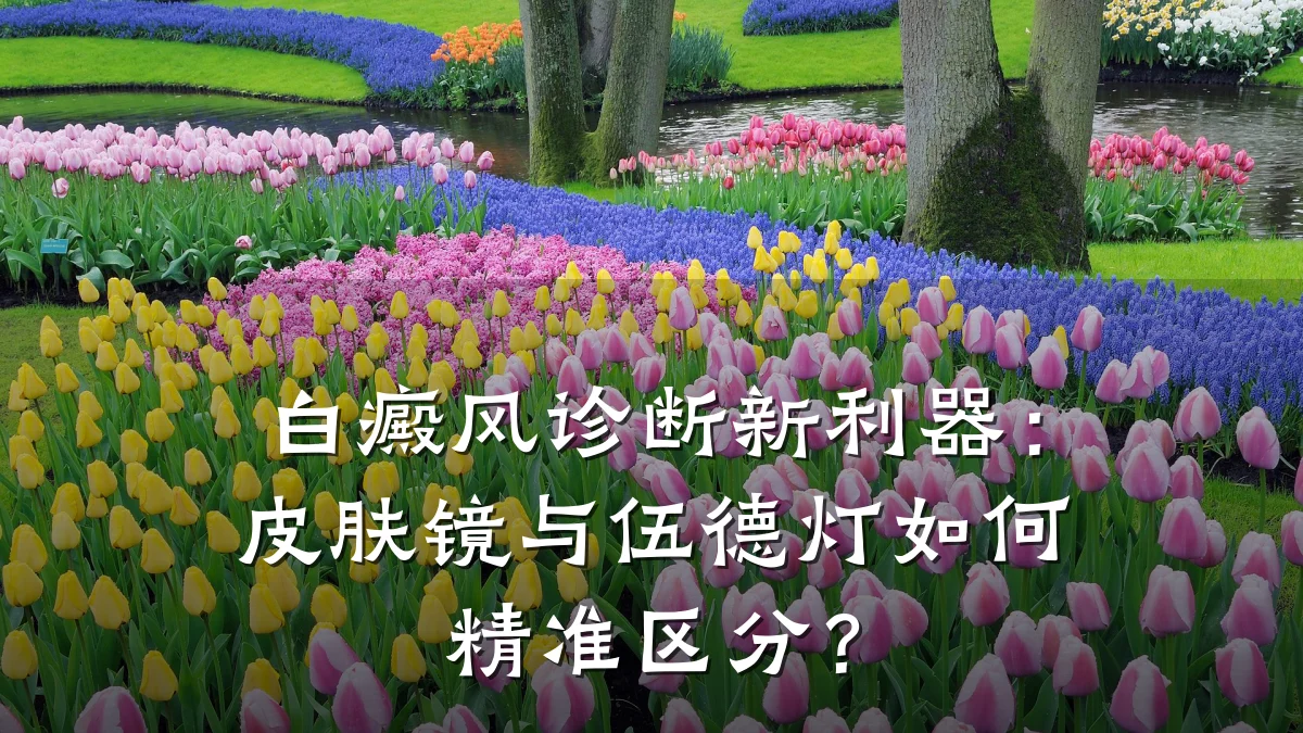白癜风诊断新利器:皮肤镜与伍德灯如何精准区分?