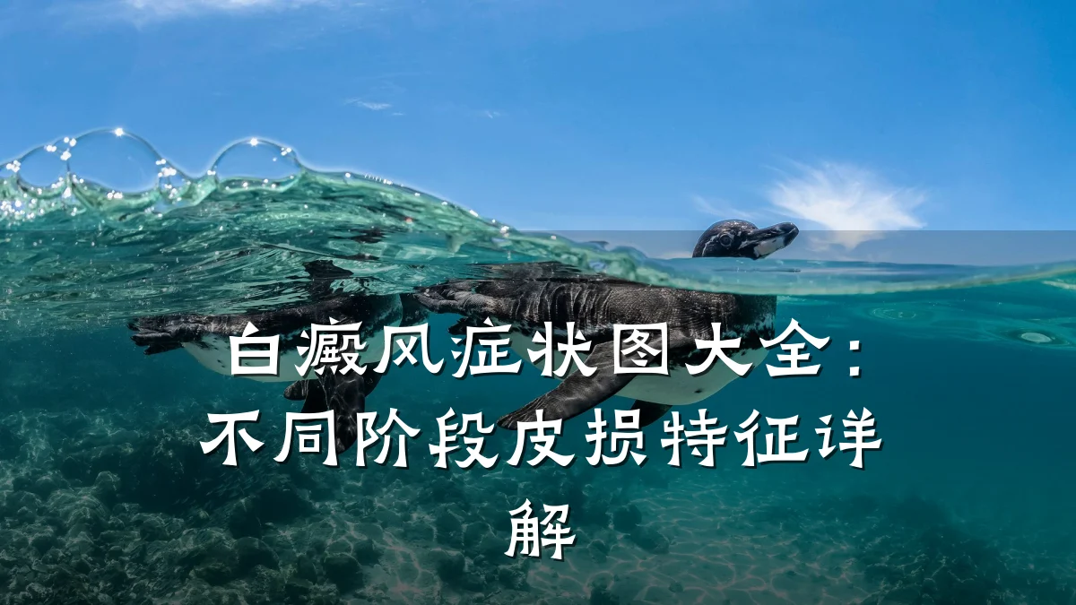 白癜风症状图大全:不同阶段皮损特征详解