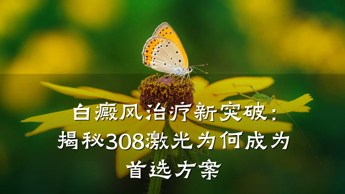 白癜风治疗新突破:揭秘308激光为何成为首选方案