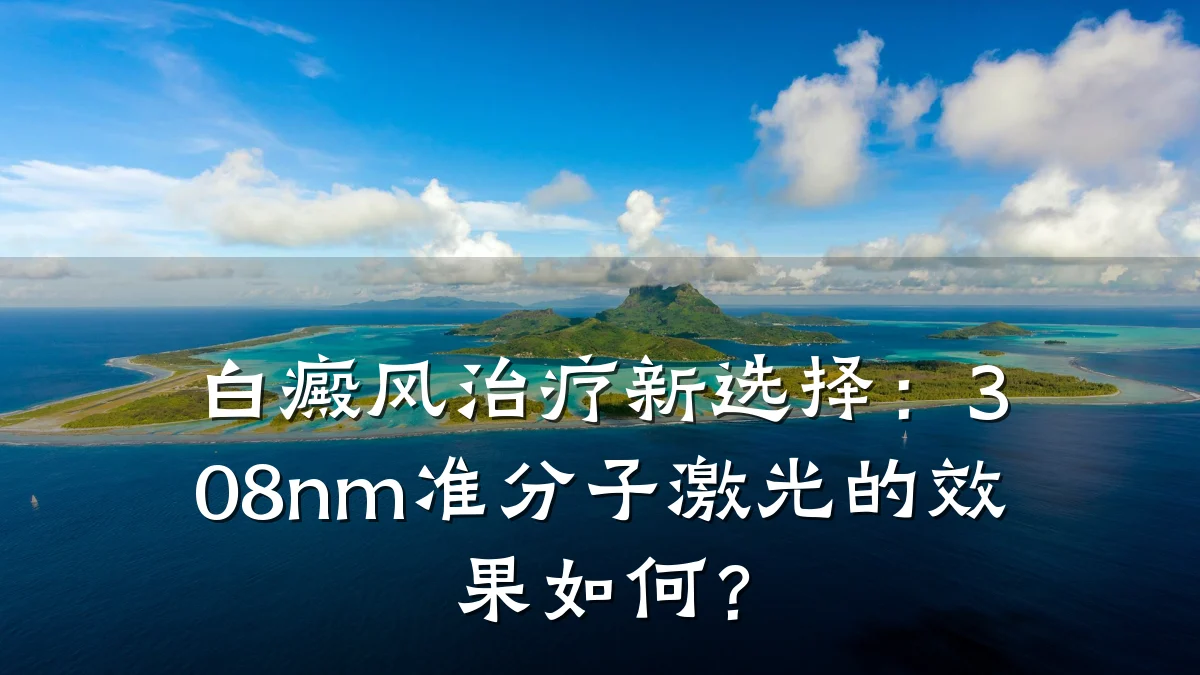 白癜风治疗新选择:308nm准分子激光的效果如何?