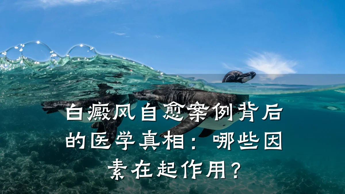 白癜风自愈案例背后的医学真相:哪些因素在起作用?