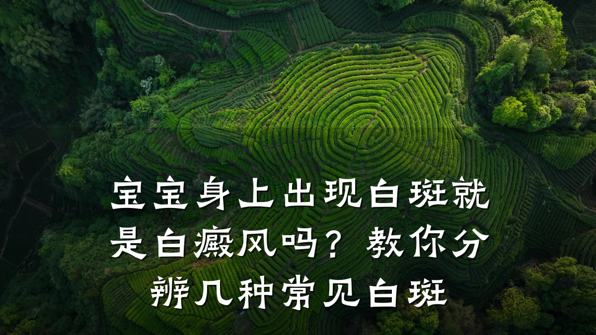 宝宝身上出现白斑就是白癜风吗?教你分辨几种常见白斑