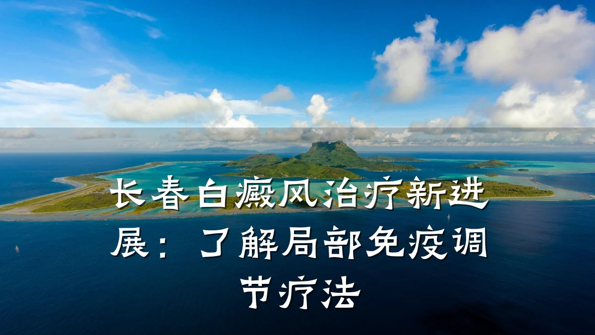 长春白癜风治疗新进展:了解局部免疫调节疗法