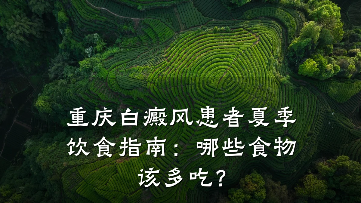 重庆白癜风患者夏季饮食指南:哪些食物该多吃?
