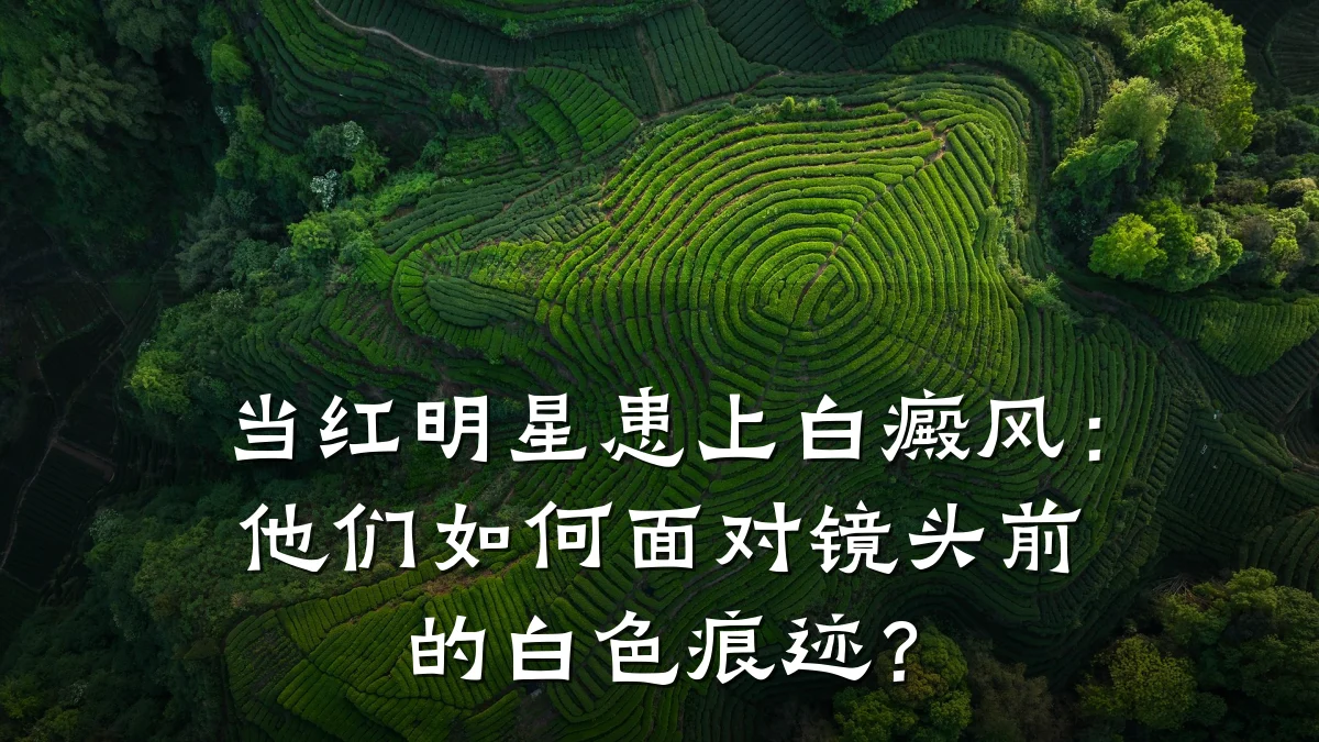 当红明星患上白癜风：他们如何面对镜头前的白色痕迹？