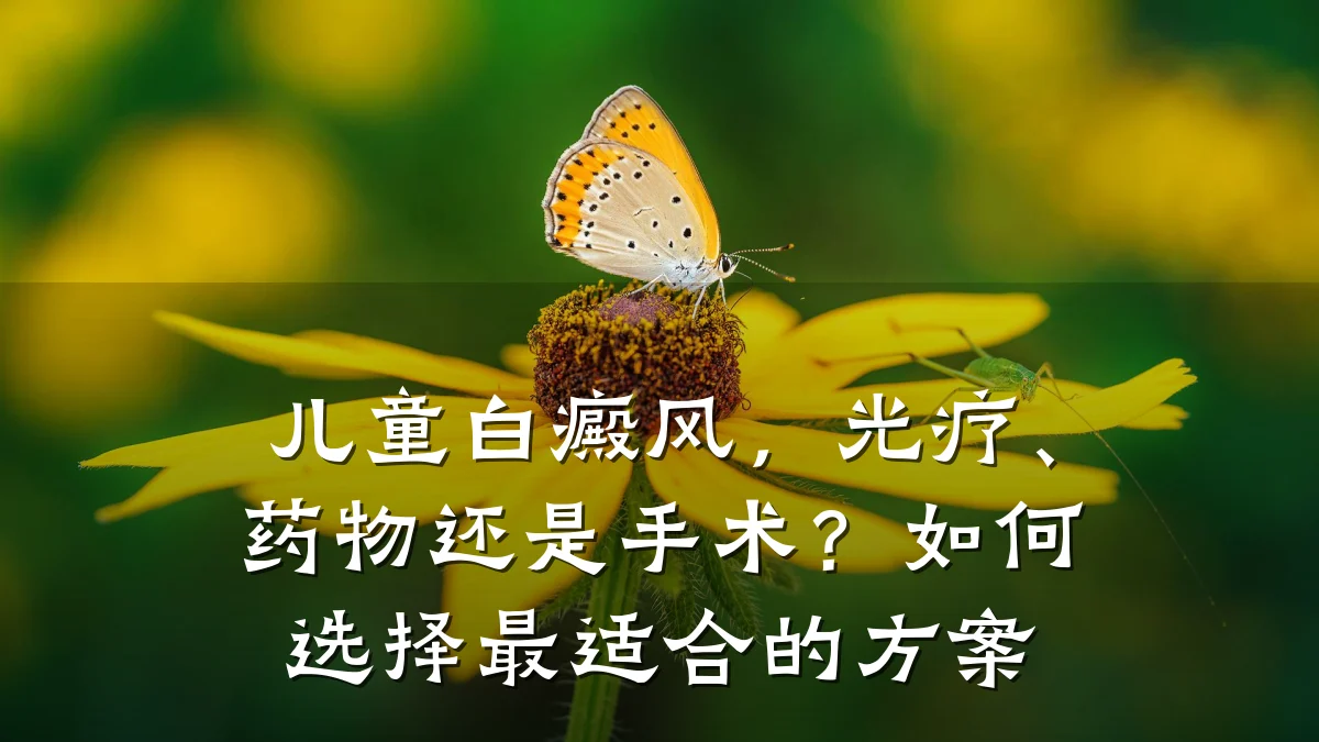儿童白癜风,光疗、药物还是手术?如何选择最适合的方案