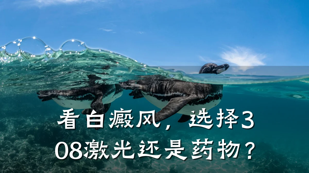 看白癜风,选择308激光还是药物?