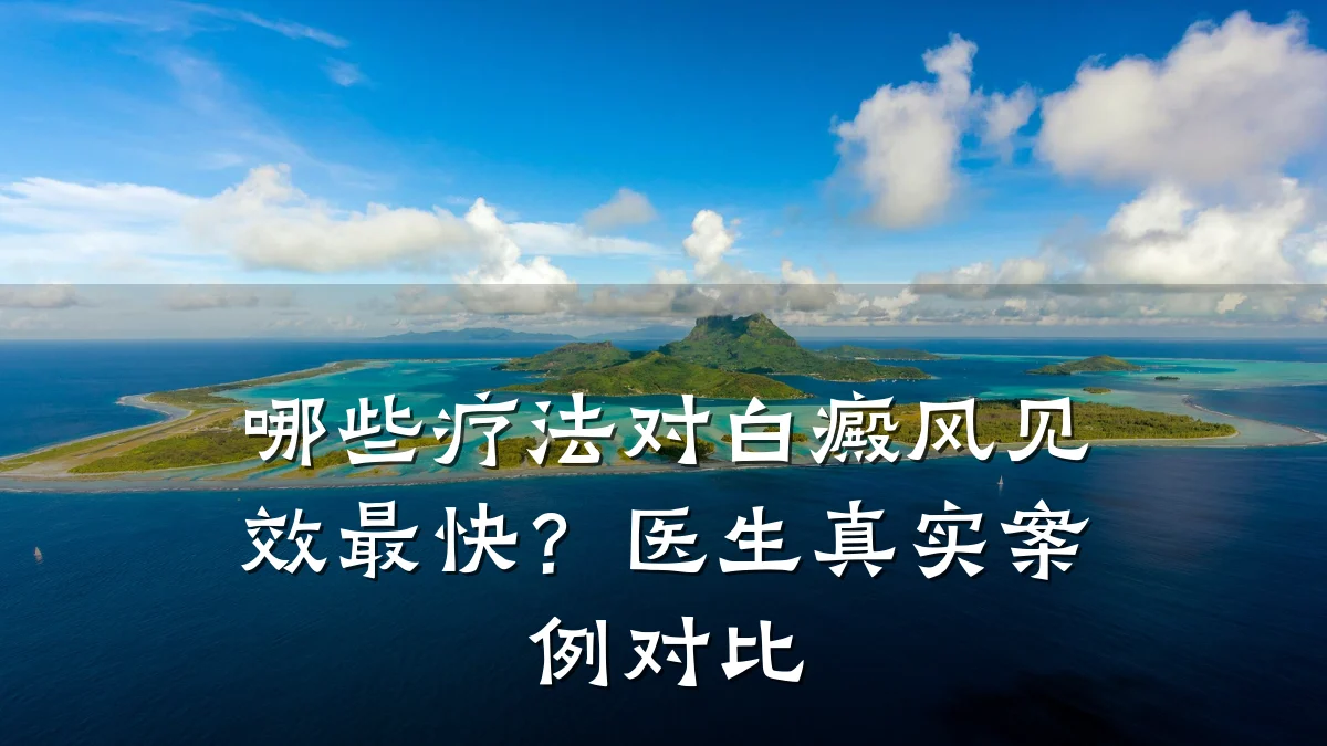 哪些疗法对白癜风见效最快?医生真实案例对比
