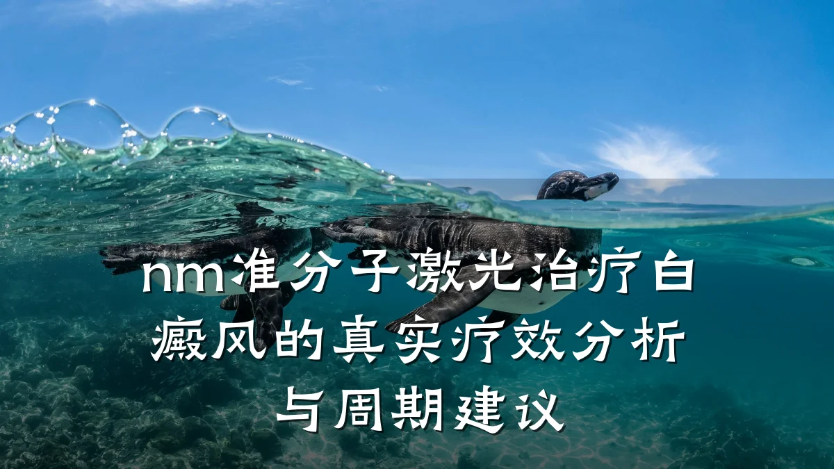 nm准分子激光治疗白癜风的真实疗效分析与周期建议