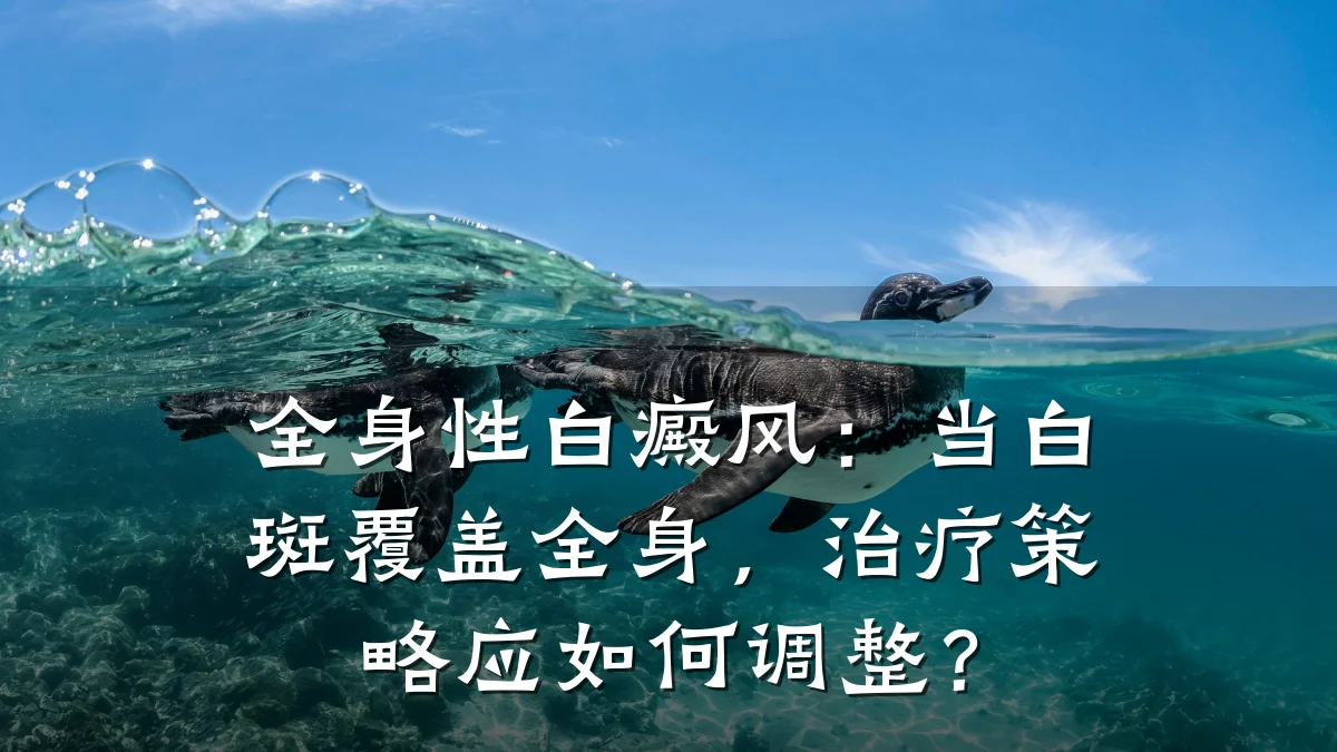 全身性白癜风:当白斑覆盖全身,治疗策略应如何调整?