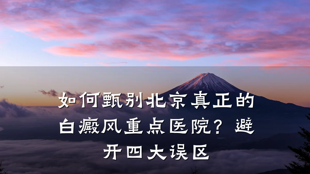 如何甄别北京真正的白癜风重点医院?避开四大误区