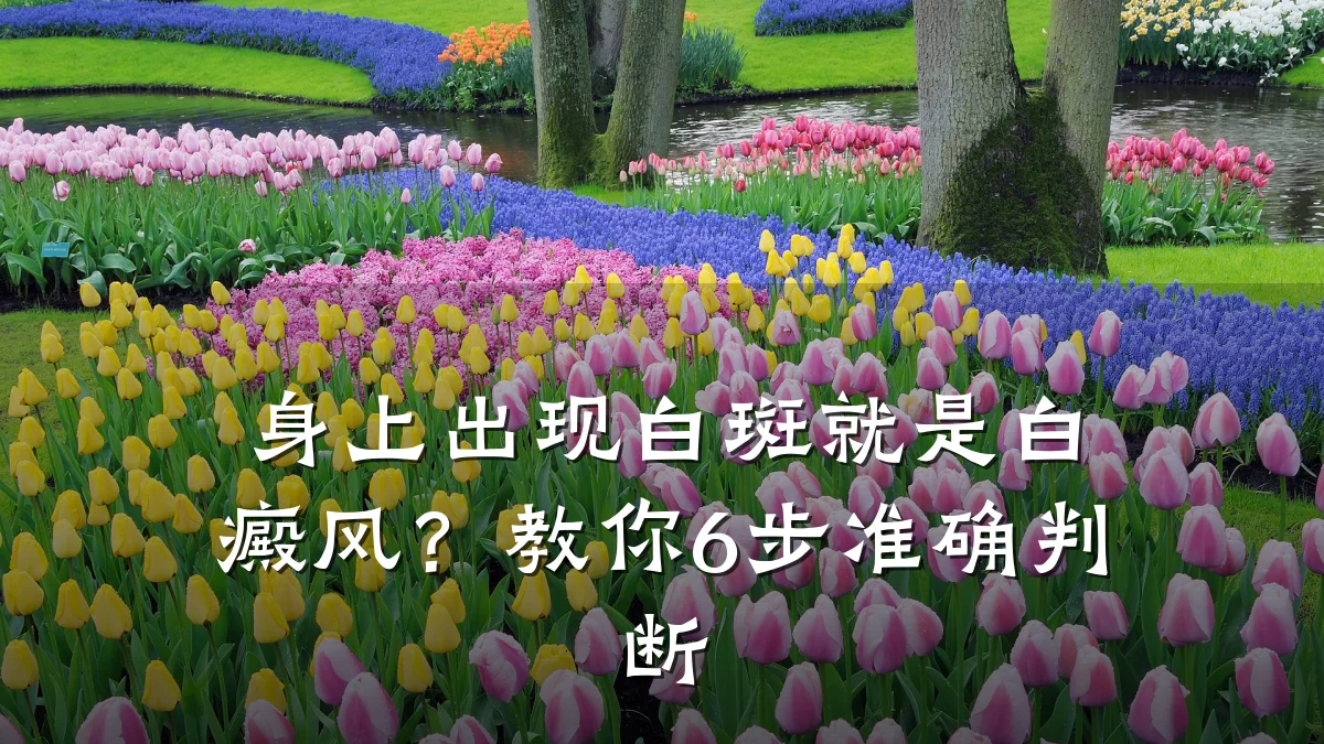 身上出现白斑就是白癜风?教你6步准确判断