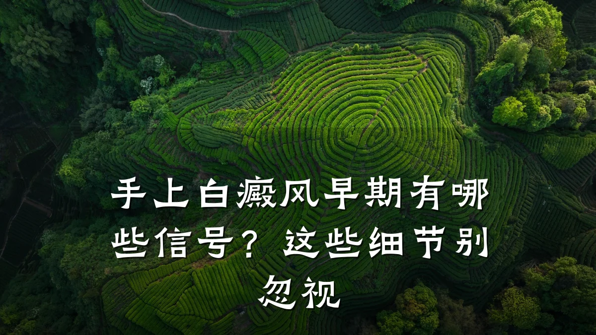 手上白癜风早期有哪些信号?这些细节别忽视