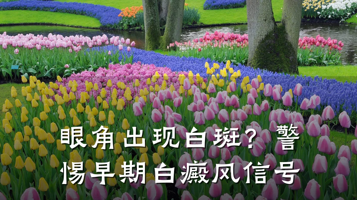 眼角出现白斑?警惕早期白癜风信号