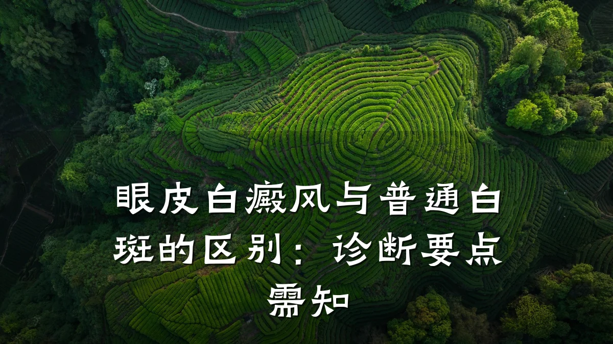 眼皮白癜风与普通白斑的区别：诊断要点需知