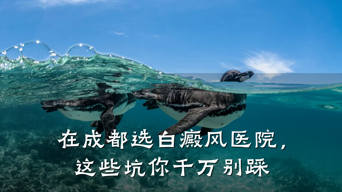 在成都选白癜风医院,这些坑你千万别踩