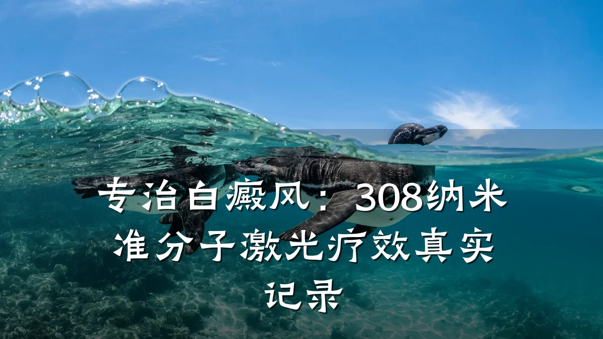 专治白癜风:308纳米准分子激光疗效真实记录