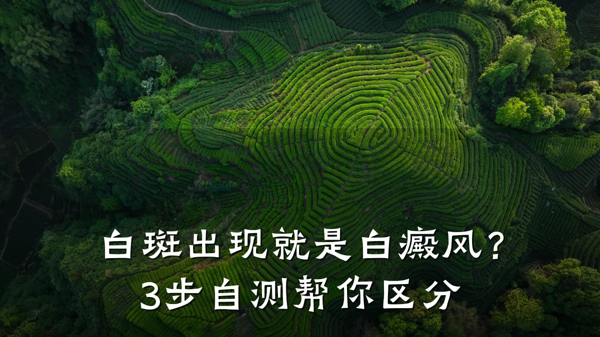 白斑出现就是白癜风？3步自测帮你区分