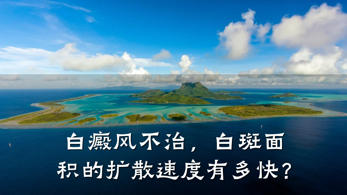 白癜风不治,白斑面积的扩散速度有多快?