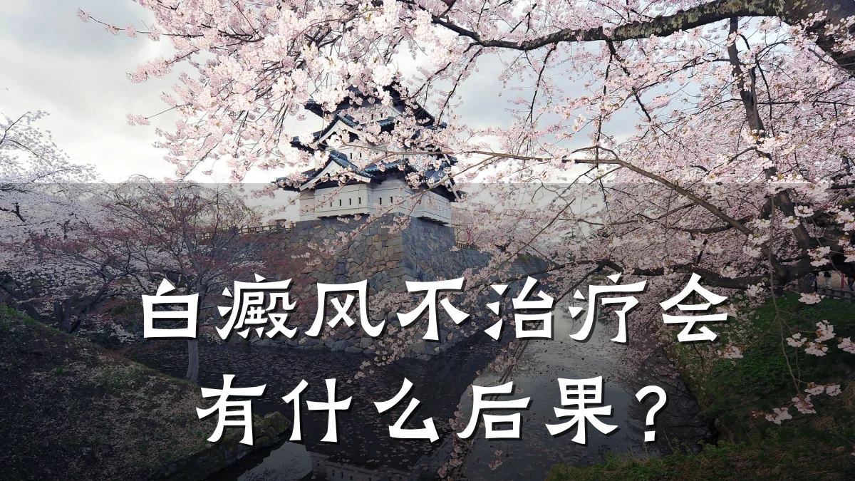 白癜风不治疗会有什么后果?