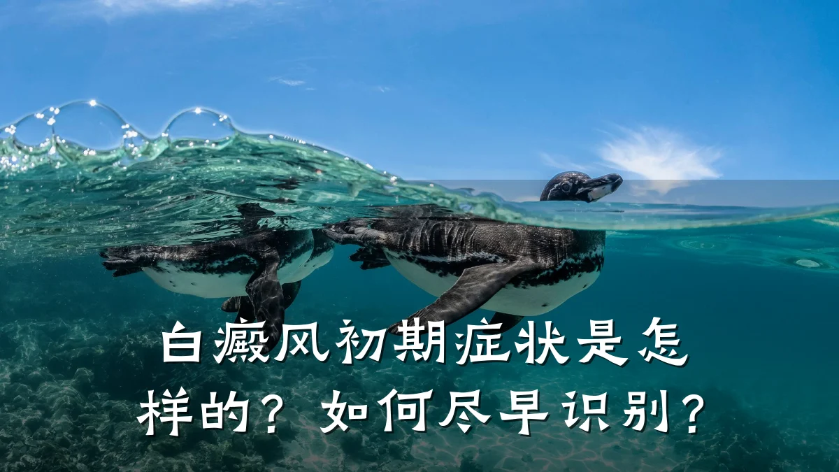 白癜风初期症状是怎样的?如何尽早识别?