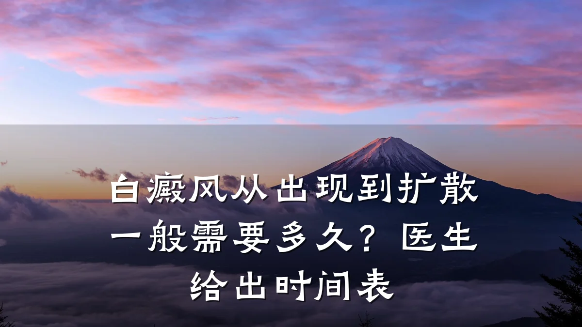 白癜风从出现到扩散一般需要多久?医生给出时间表