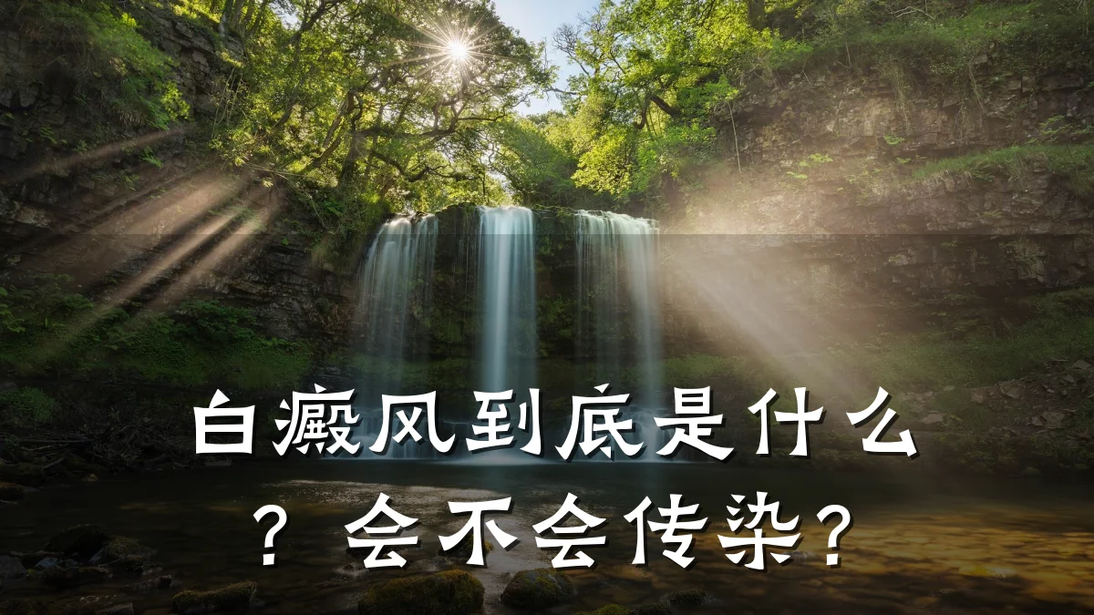 白癜风到底是什么?会不会传染?