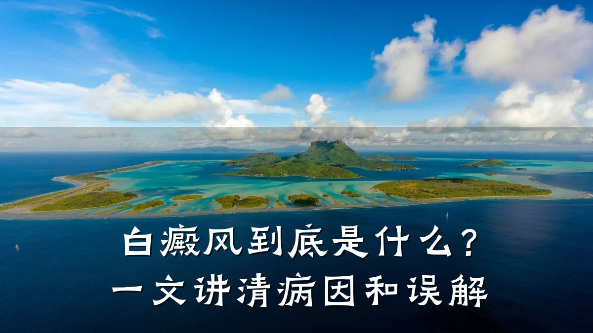 白癜风到底是什么?一文讲清病因和误解