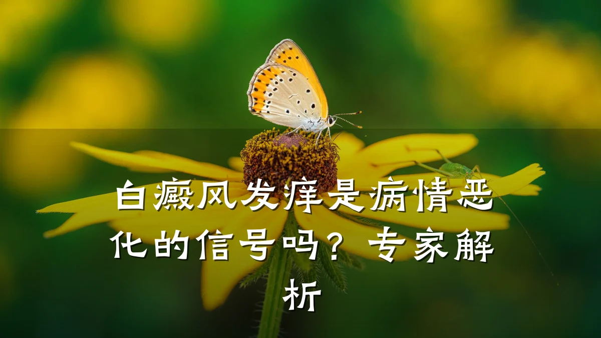 白癜风发痒是病情恶化的信号吗?专家解析