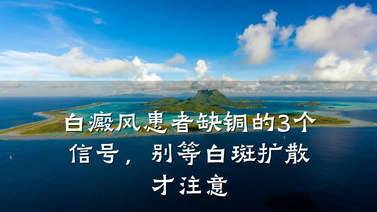白癜风患者缺铜的3个信号,别等白斑扩散才注意