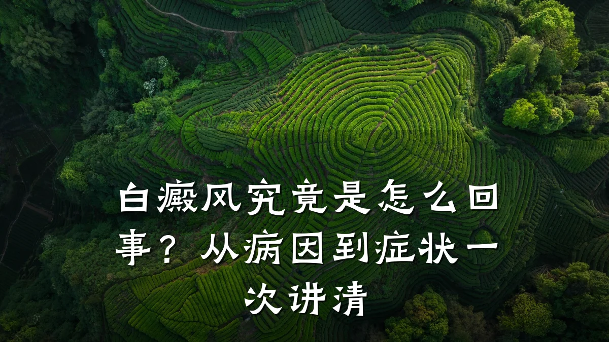 白癜风究竟是怎么回事?从病因到症状一次讲清