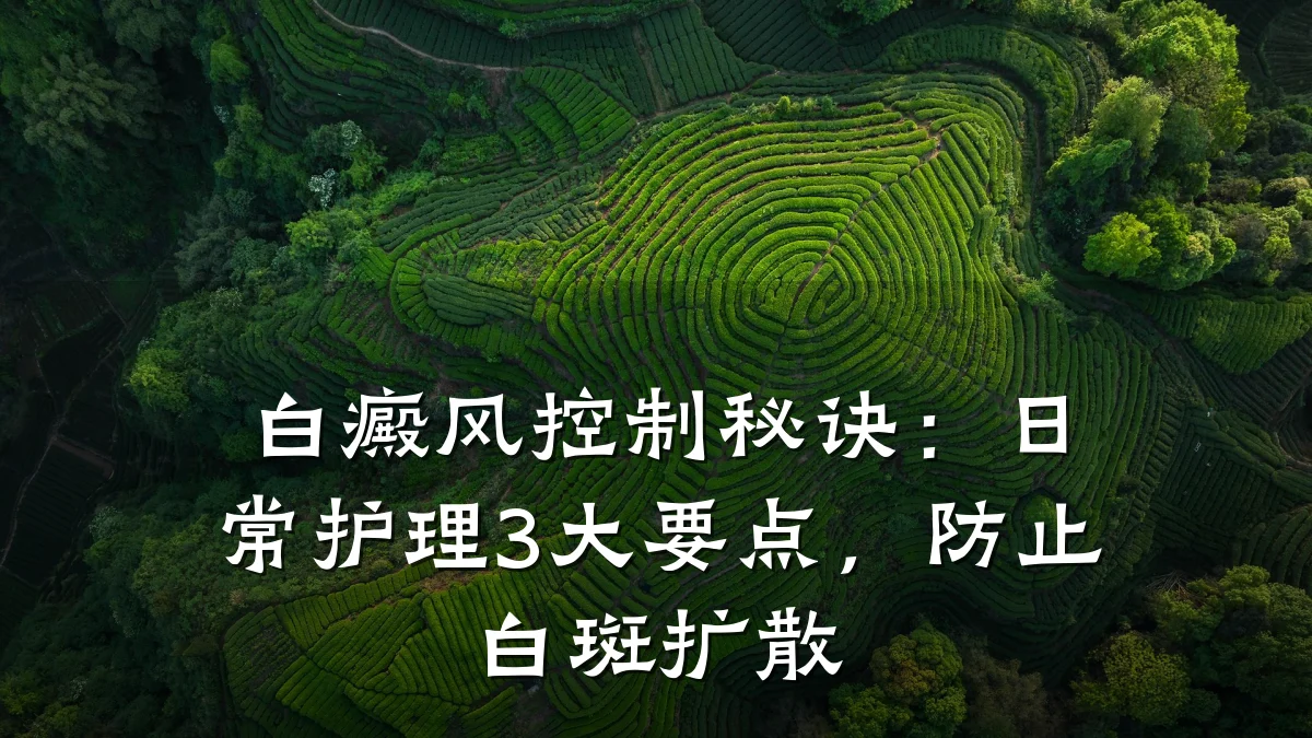 白癜风控制秘诀：日常护理3大要点，防止白斑扩散