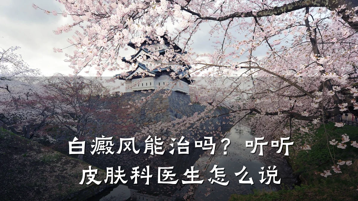 白癜风能治吗?听听皮肤科医生怎么说