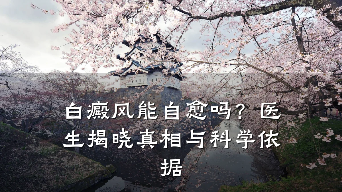 白癜风能自愈吗?医生揭晓真相与科学依据