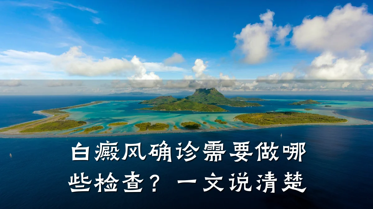 白癜风确诊需要做哪些检查?一文说清楚