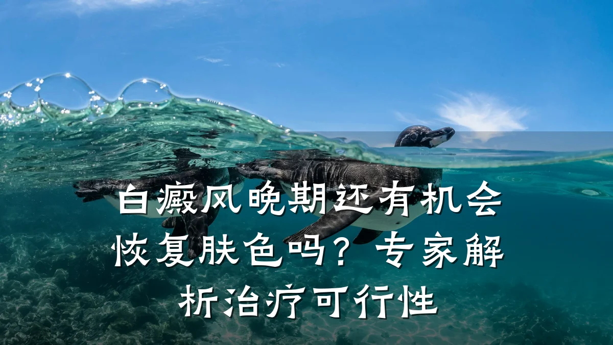 白癜风晚期还有机会恢复肤色吗？专家解析治疗可行性