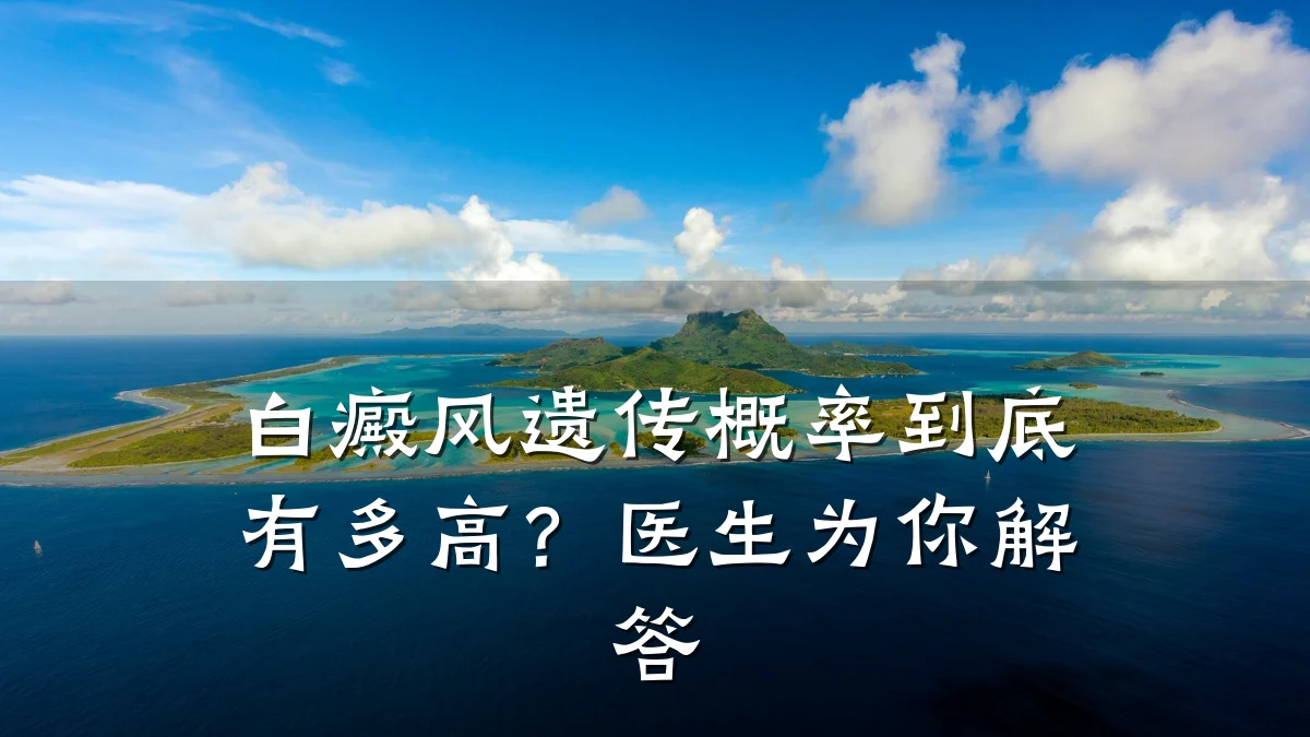 白癜风遗传概率到底有多高？医生为你解答