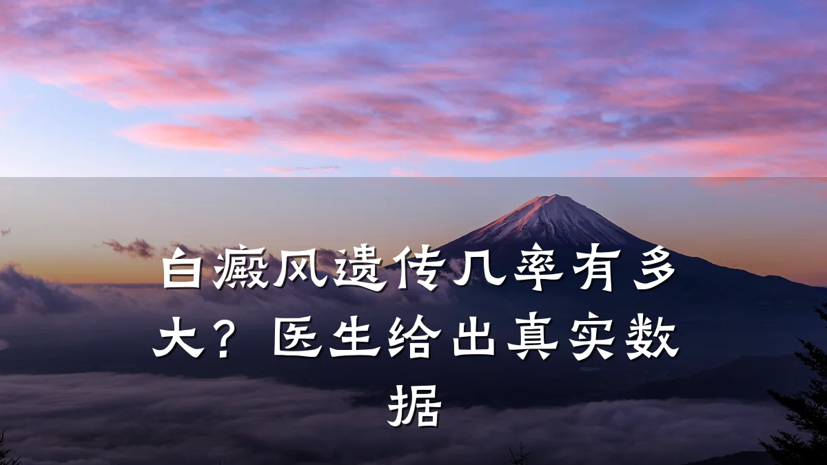 白癜风遗传几率有多大?医生给出真实数据