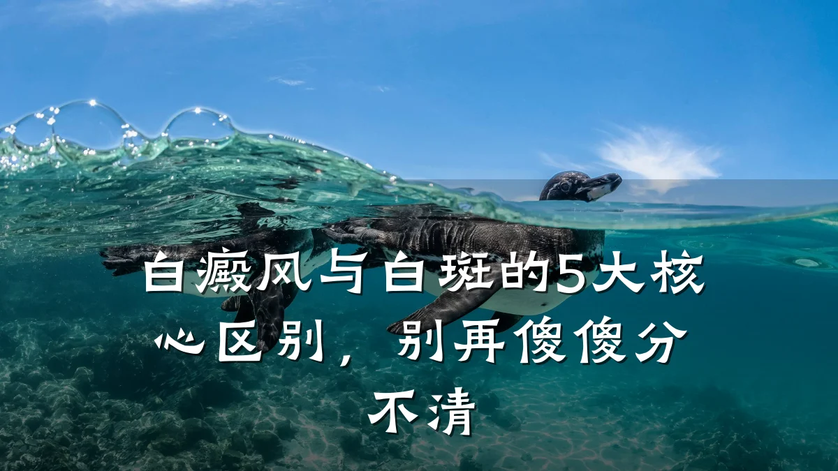 白癜风与白斑的5大核心区别,别再傻傻分不清