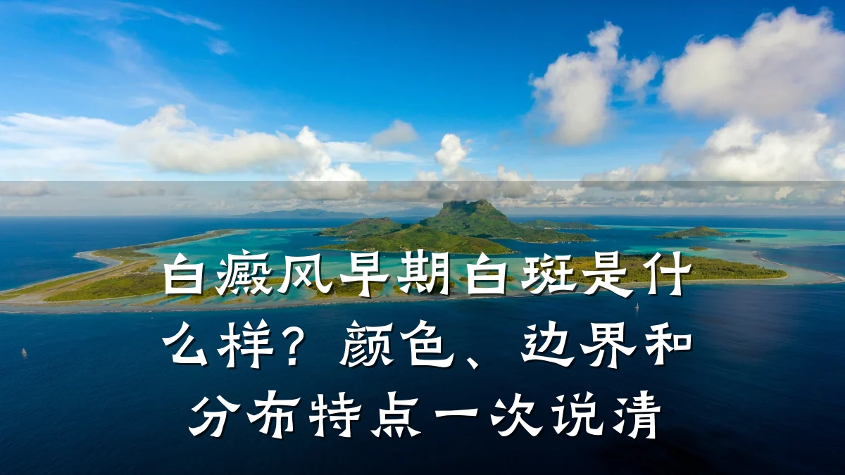 白癜风早期白斑是什么样?颜色、边界和分布特点一次说清