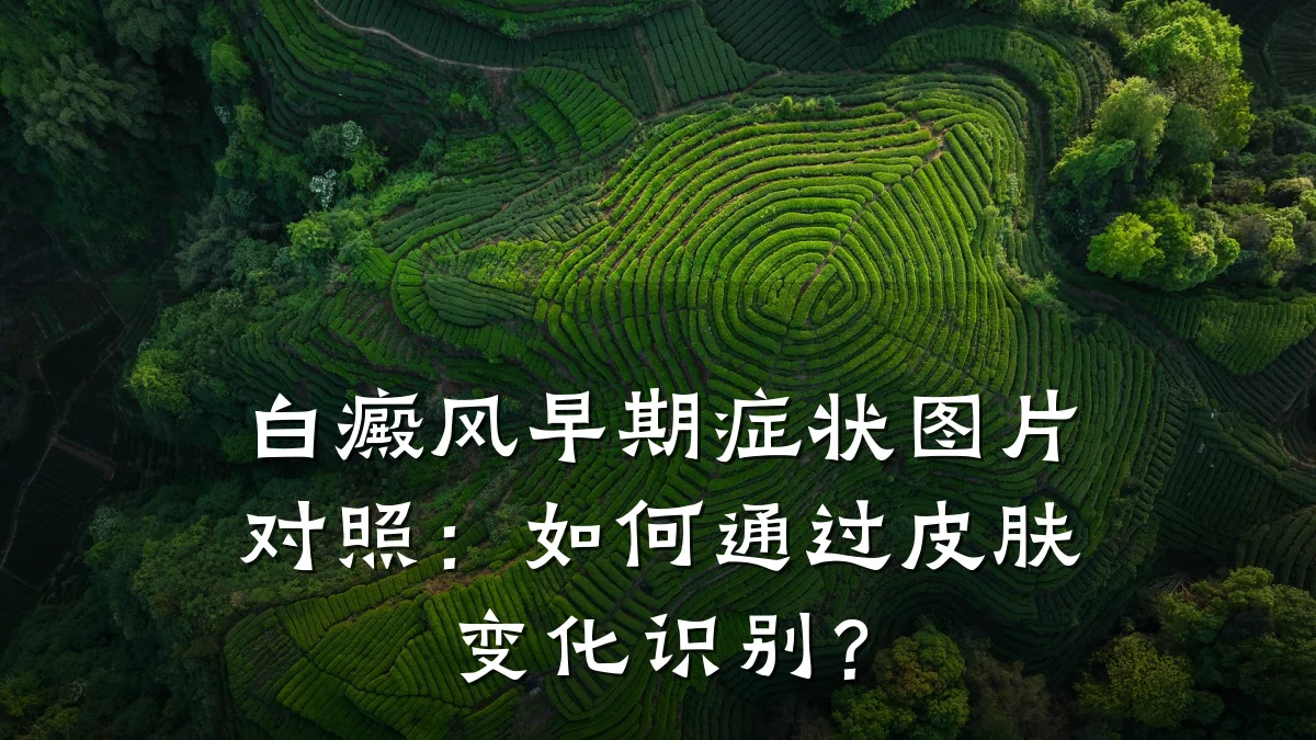 白癜风早期症状图片对照:如何通过皮肤变化识别?