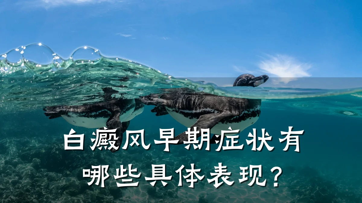 白癜风早期症状有哪些具体表现?