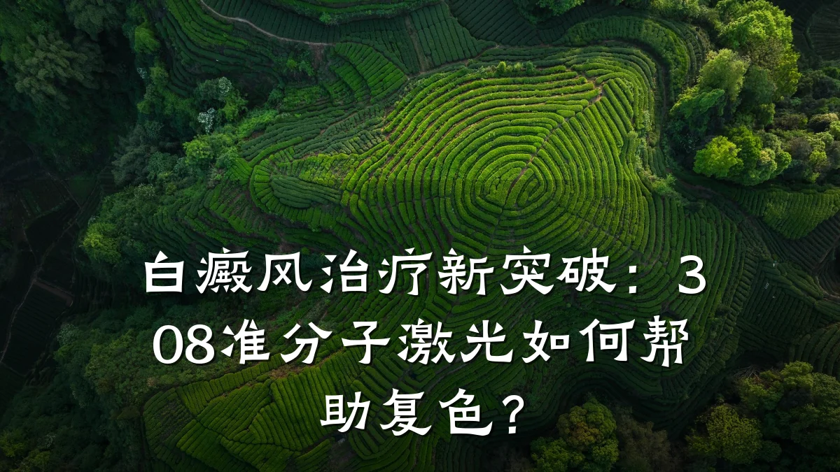 白癜风治疗新突破:308准分子激光如何帮助复色?