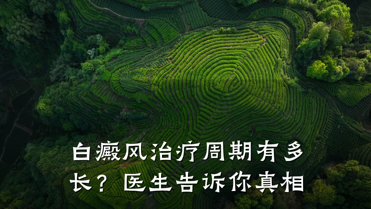 白癜风治疗周期有多长?医生告诉你真相