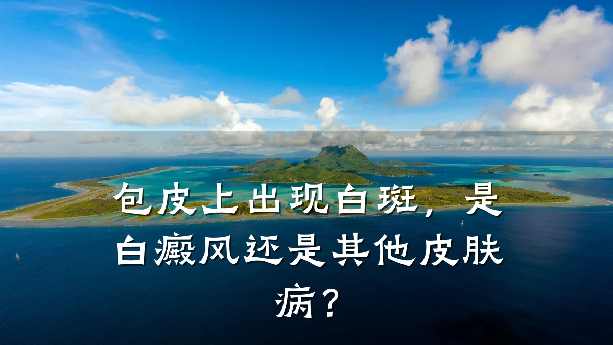 包皮上出现白斑,是白癜风还是其他皮肤病?