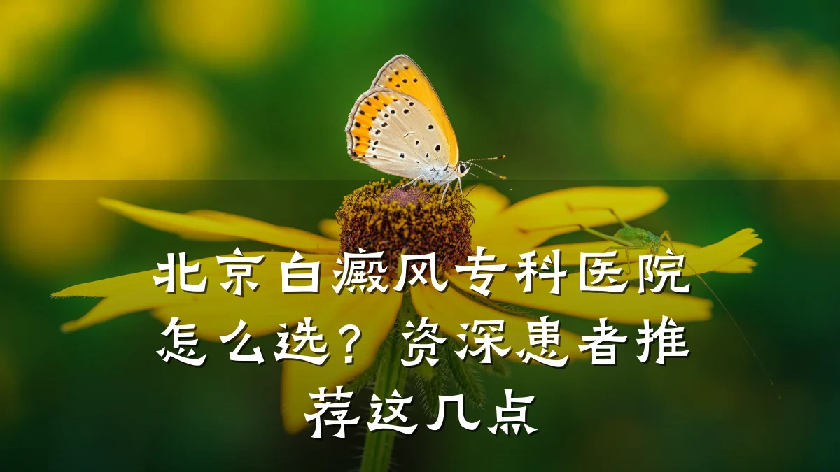 北京白癜风专科医院怎么选?资深患者推荐这几点
