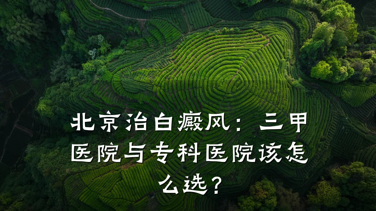北京治白癜风:三甲医院与专科医院该怎么选?