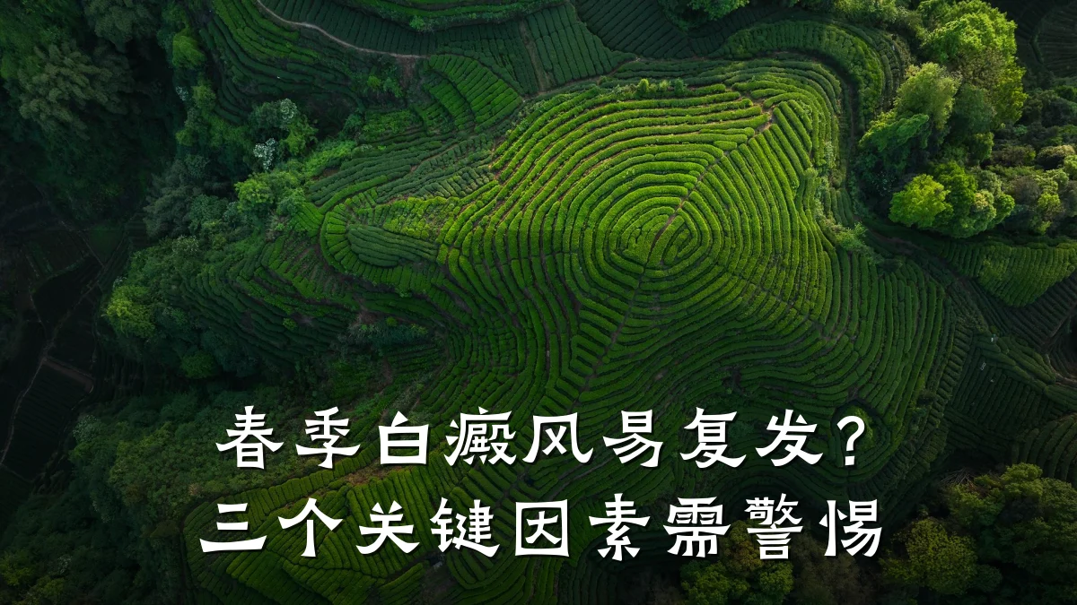 春季白癜风易复发?三个关键因素需警惕