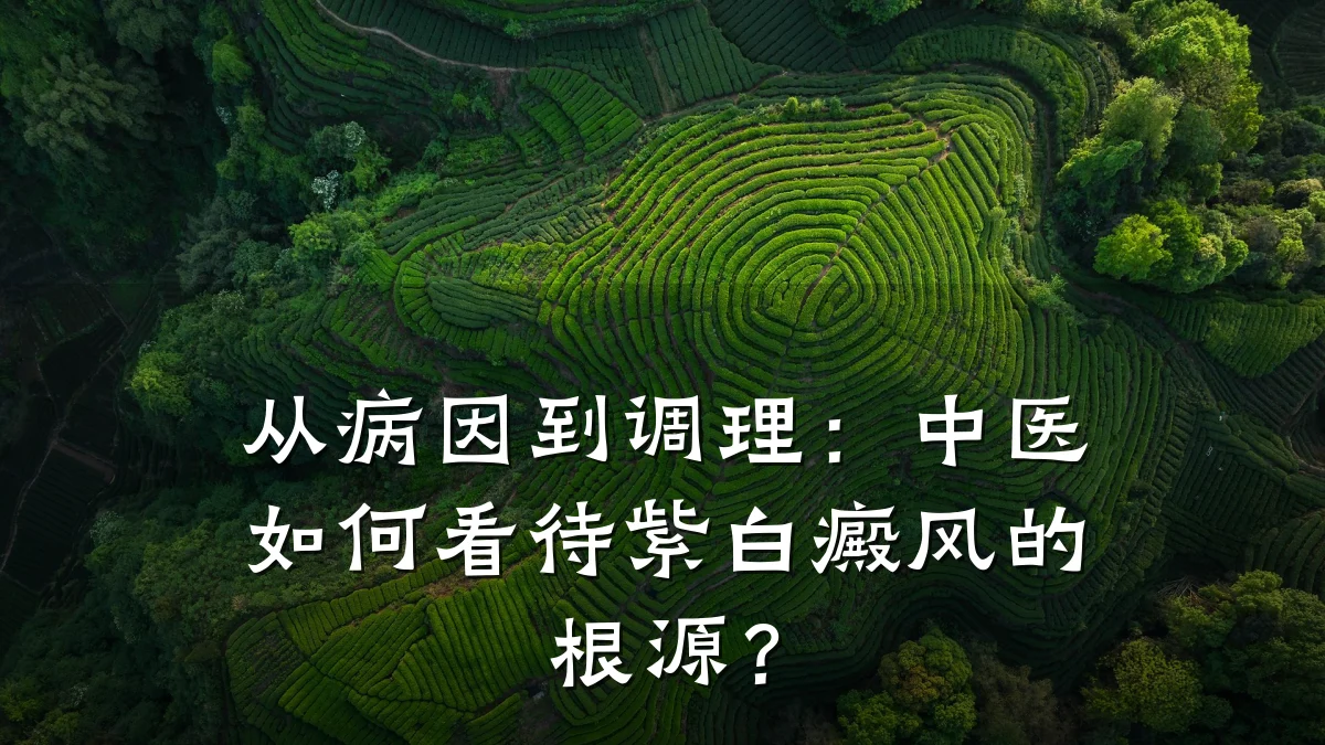 从病因到调理:中医如何看待紫白癜风的根源?