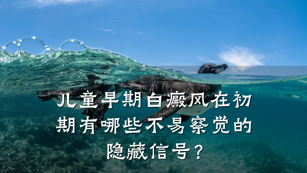 儿童早期白癜风在初期有哪些不易察觉的隐藏信号?